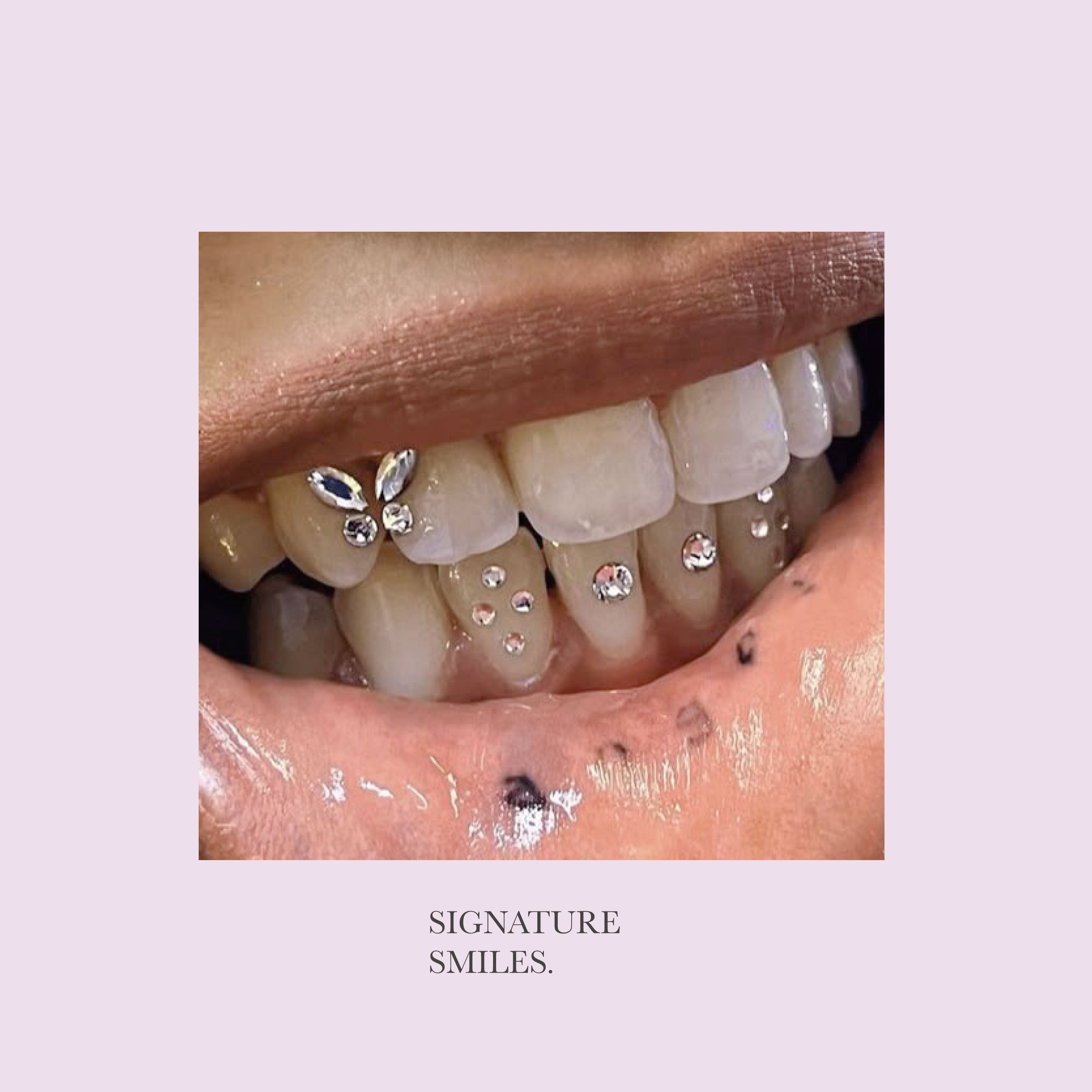 Double Butterfly DIY Tooth Gem Kit